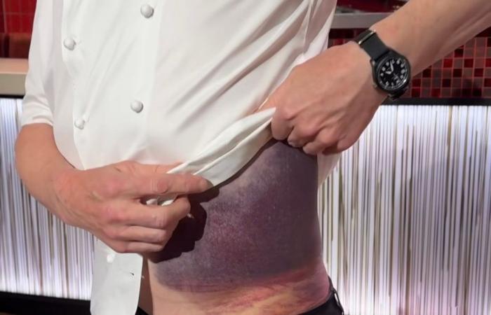 „Ich habe Glück, hier zu sein“ … Chefkoch Gordon Ramsay präsentiert seine beeindruckende Verletzung nach einem Fahrradsturz