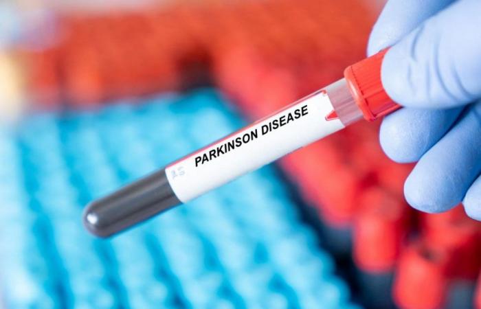 Ein Bluttest könnte die Parkinson-Krankheit bis zu 7 Jahre vor den Symptomen vorhersagen