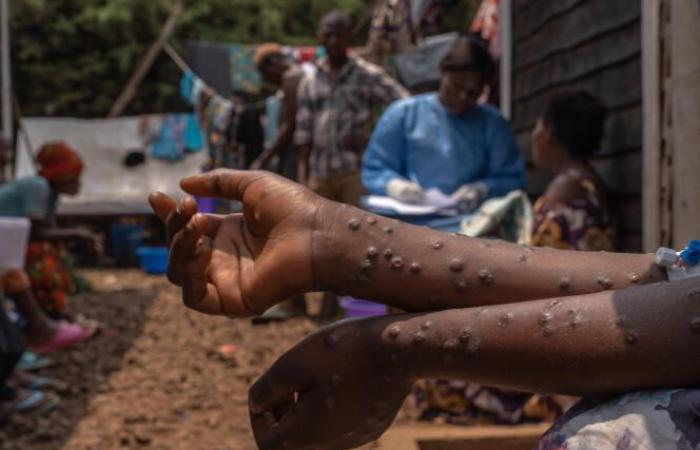 Nach Angaben der afrikanischen Gesundheitsbehörde CDC gab es seit Jahresbeginn 866 Todesfälle