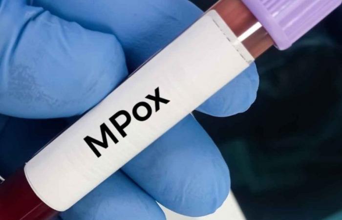 Ein neues Mpox-Diagnosekit steht zur Vermarktung in Marokko bereit