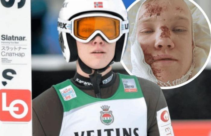 Dieser Skispringer erholt sich nicht von seinem schrecklichen Sturz in der Schweiz