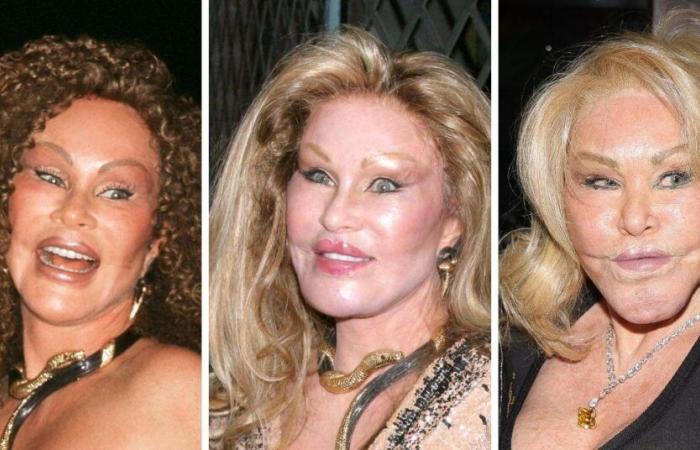 Jocelyn Wildensteins Transformationsgalerie: Vorher-Nachher-Fotos