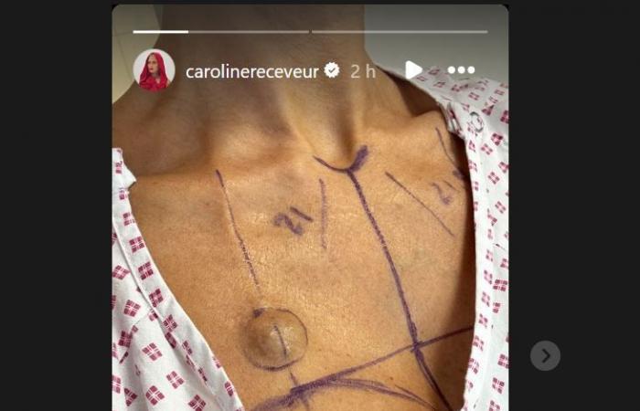 Caroline Receveur „mit 37 leichter als je zuvor“: Brustverkleinerung und keine Implantate mehr, sie teilt Fotos ihrer Freiheit