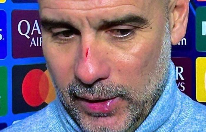 „Ich wollte mir weh tun“: Als Pep Guardiola zugibt, sich nach dem unglaublichen Unentschieden bei Manchester City am Gesicht gekratzt zu haben