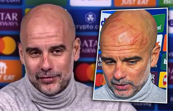 VIDEO. Warum Pep Guardiola mit einem Gesicht voller Kratzer zur Konferenz kam