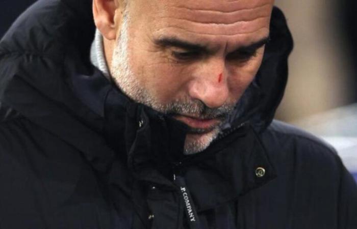 Guardiola relativiert seine Aussagen aufgrund der Kratzer im Gesicht