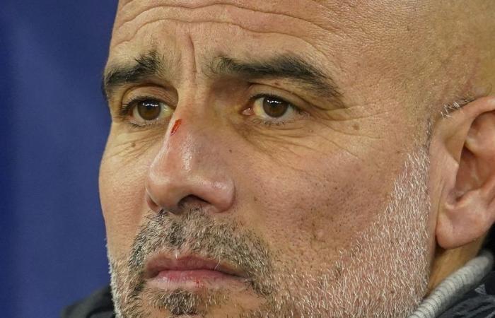 Fußball: Guardiola kehrt nach seiner Nasennarbe zu seinem Witz zurück