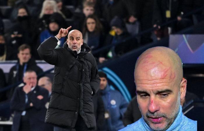 Guardiola hatte sich den Schädel zerkratzt und wollte sich nach dem Feyenoord-Comeback „verletzen“.