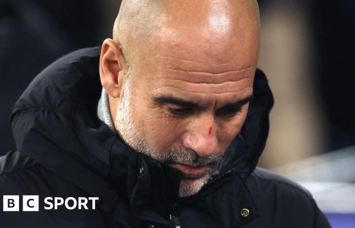 Pep Guardiola: Der Trainer von Manchester City stellt klar, dass er sich nach der Niederlage gegen Feyenoord „mir selbst schade“ habe