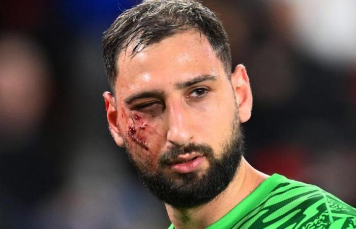 „Gesichtstrauma mit mehreren Wunden“ für Donnarumma