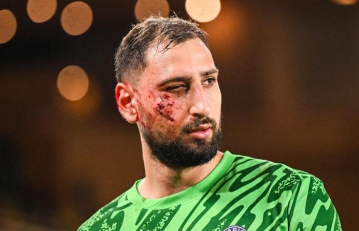 PSG: Für Donnarumma wurde eine erste Diagnose gestellt