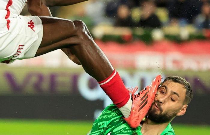 Gesicht in Fetzen, Klammern angebracht: das schockierende Foto der Verletzung von PSG-Torhüter Gianluigi Donnarumma