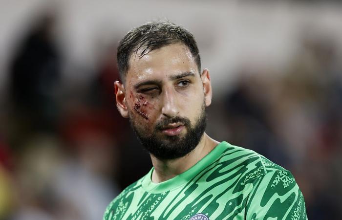 Singo entschuldigt sich, nachdem er Donnarumma unabsichtlich verletzt hat