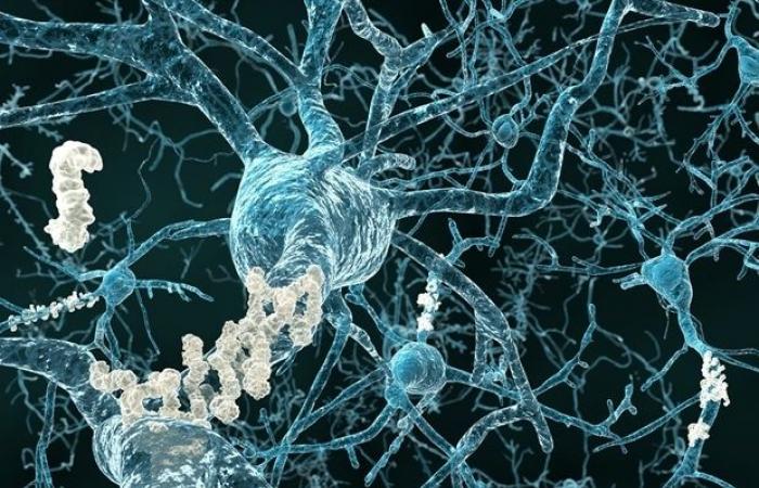 Forscher identifizieren Schlüsselmechanismus, der Gehirnstress mit der Alzheimer-Krankheit verbindet