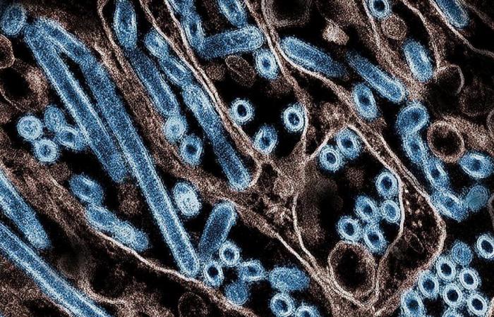 Vogelgrippe: Das Virus könnte im Körper eines amerikanischen Patienten mutiert sein