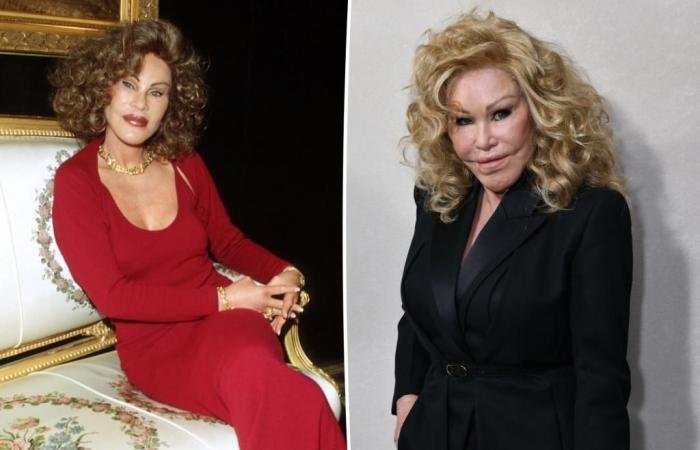 Jocelyn Wildenstein, „Catwoman“, stirbt im Alter von 84 Jahren