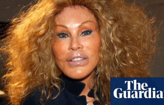 Jocelyne Wildenstein, Prominente, bekannt für extreme katzenartige Schönheitsoperationen, stirbt im Alter von 84 Jahren | Paris