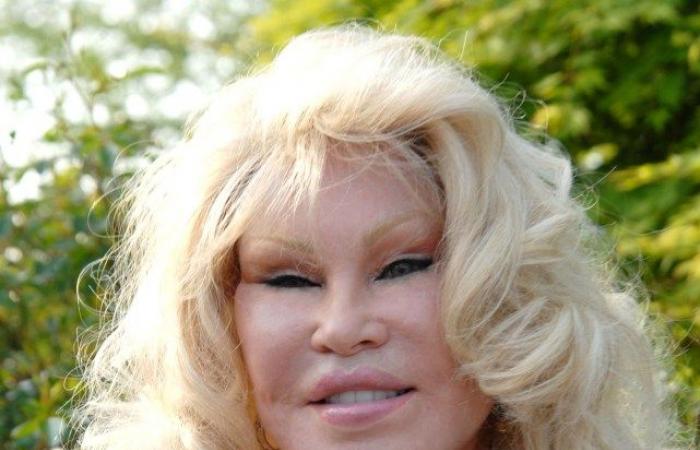 Jocelyn Wildenstein tot: „Catwoman“-Prominente, bekannt für extreme Schönheitsoperationen, stirbt im Alter von 84 Jahren