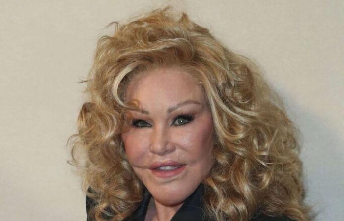 Tod von Jocelyn Wildenstein, der „Katzenfrau“ des Jetsets