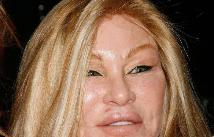 „Man muss darauf achten, den richtigen Chirurgen zu haben“: Welchen Operationen unterzog sich Jocelyne Wildenstein, auch „Katzenfrau“ genannt?