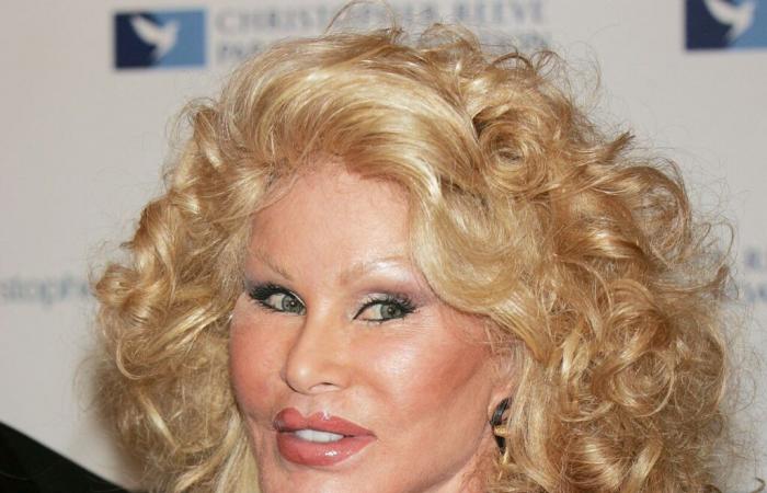 Jocelyne Wildenstein, Spitzname „Katzenfrau“ und Figur des Jetsets, ist tot