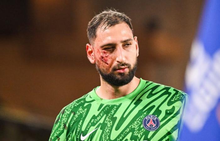 Angst vor Duellen, psychische Nachwirkungen … Wie wird sich Donnarumma von seiner schrecklichen Gesichtsverletzung erholen?