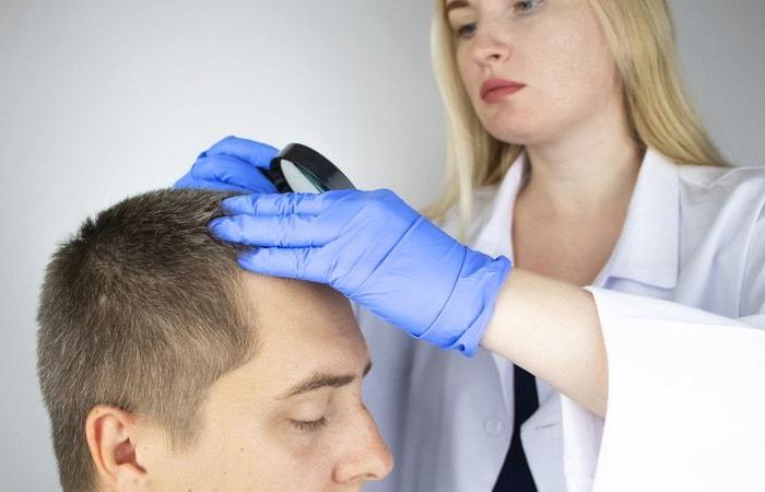 Alopezie-Pathologien der Kopfhaut: erkennen, behandeln