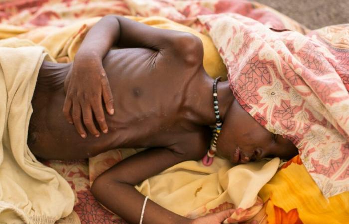 Sudan: 3,2 Millionen Kinder von Unterernährung bedroht