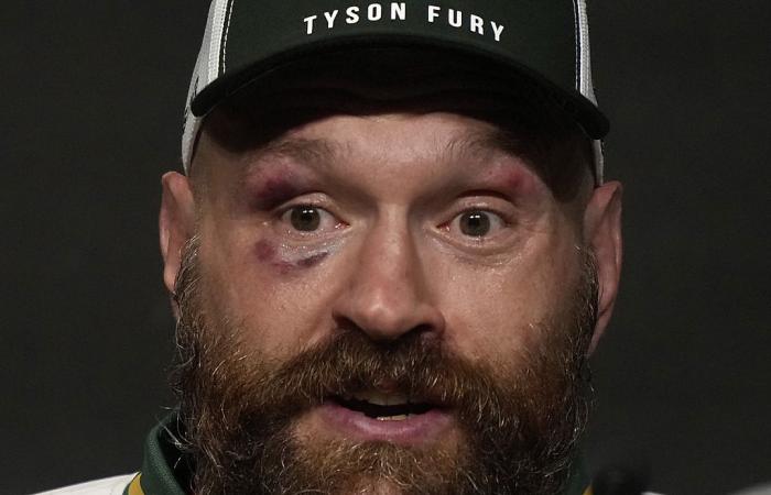 Tyson Fury gibt seinen Rücktritt bekannt