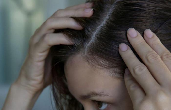 Warum haben 20-30-Jährige immer früher graue Haare?