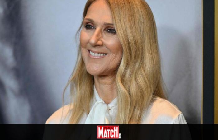 Céline Dion verrät ihr Geheimnis für ein Facelift ohne Schönheitsoperationen und es kostet überhaupt nichts