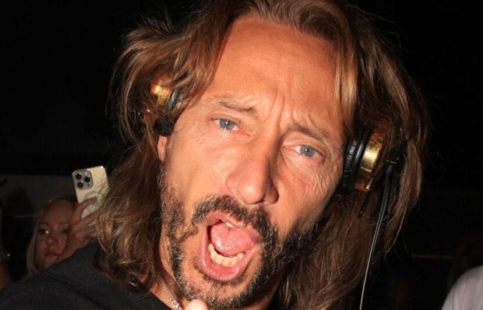 Bob Sinclar erklärt endlich sein verändertes Gesicht